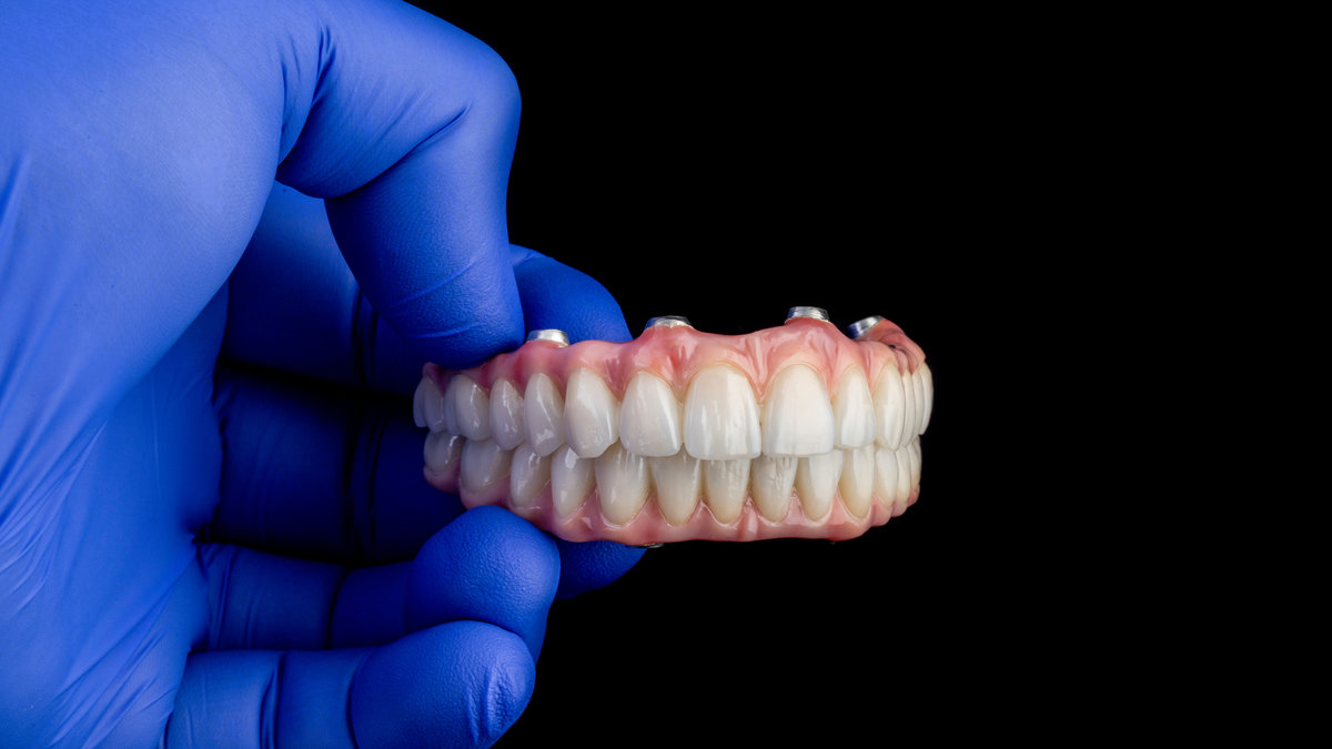 Dental implants and dentures in close-up Siemke on a black background