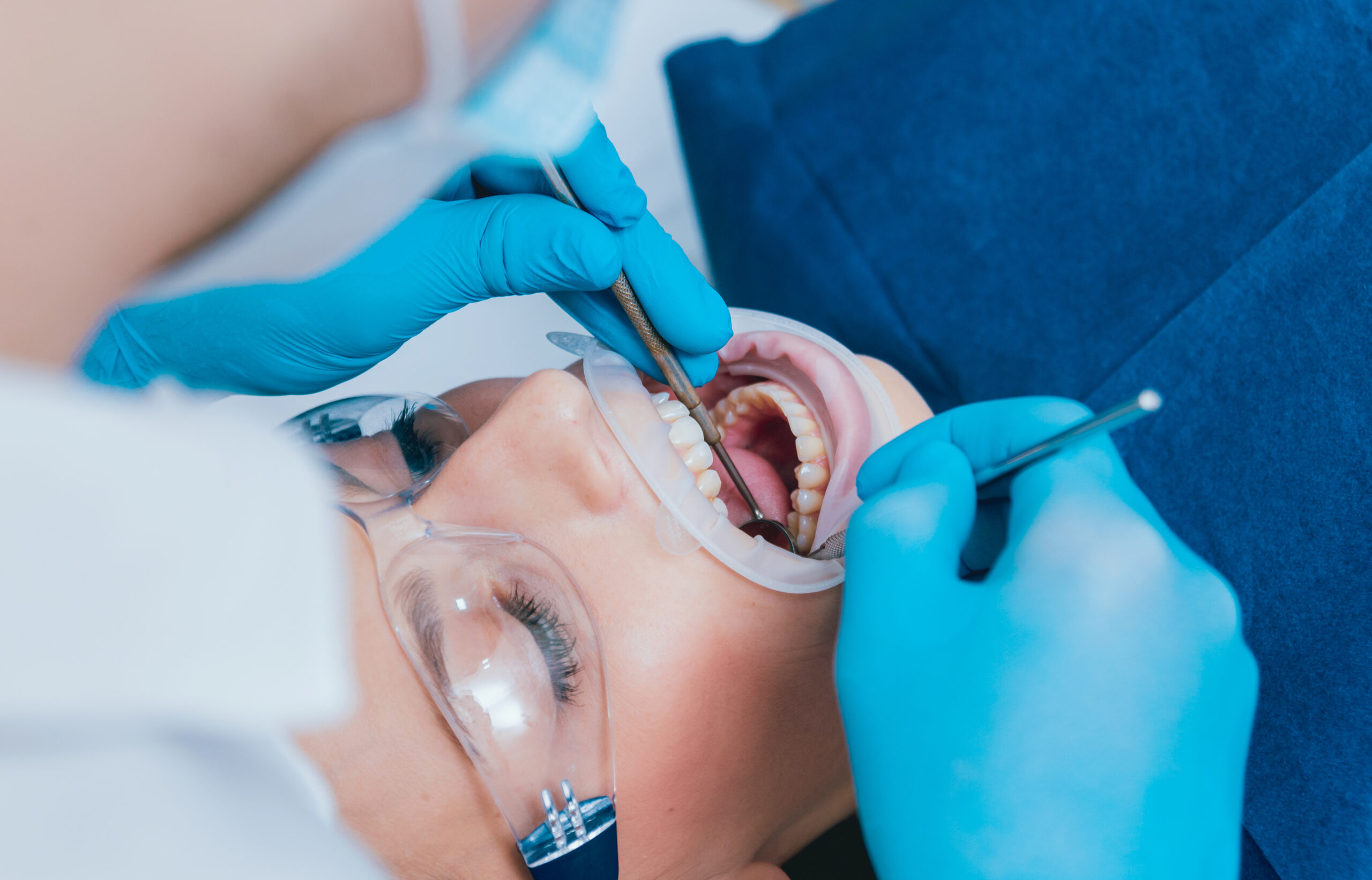 Dental treatment with expander. Modern technology