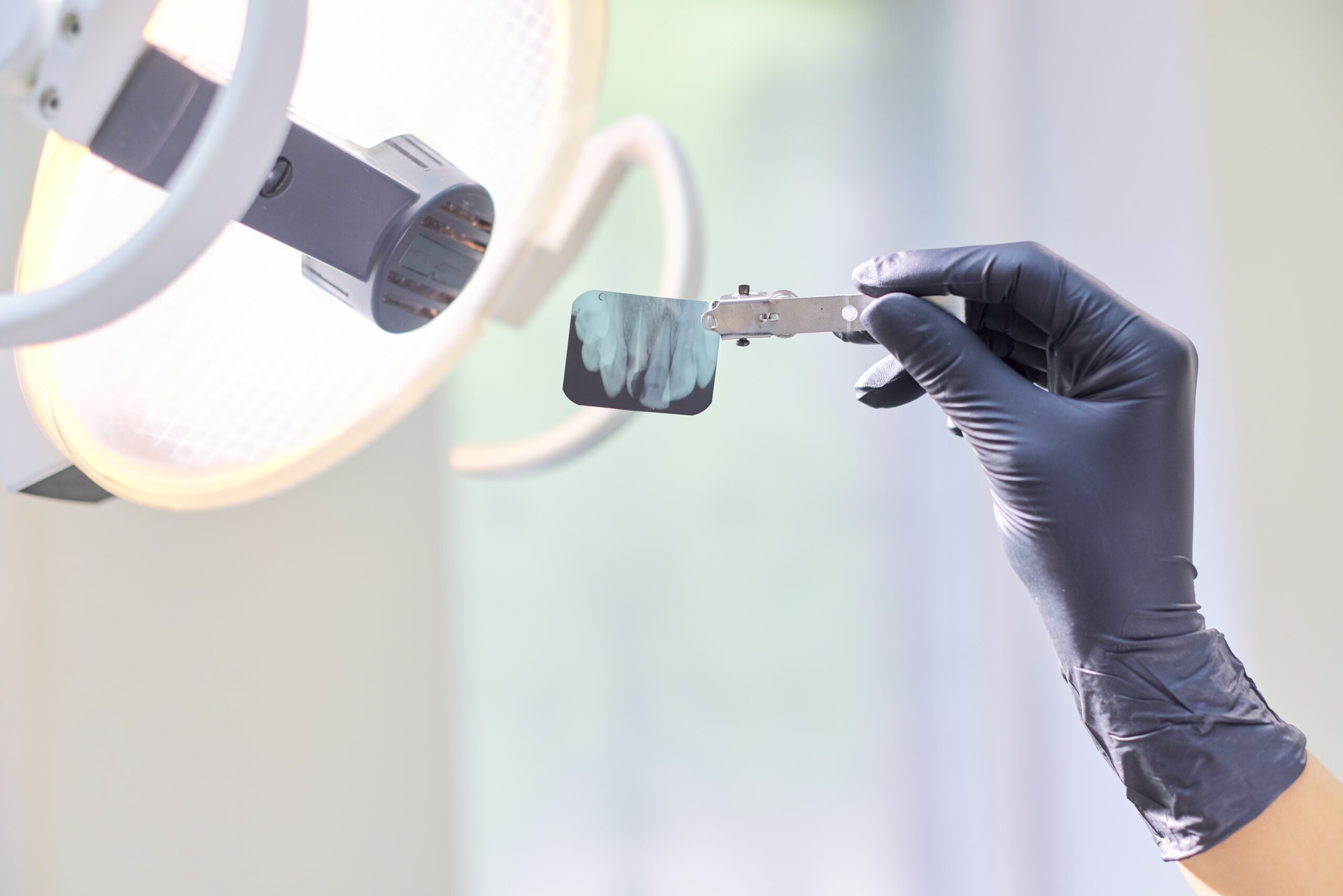 Dentist reviewing a dental X-ray with a patient during a ridge augmentation consultation